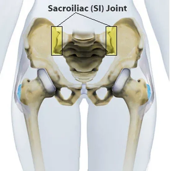 mri sacroiliac joint